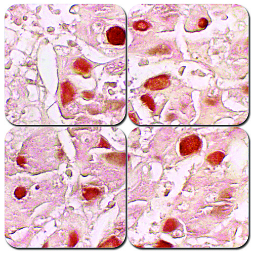 Hepatitis B Stain Kit