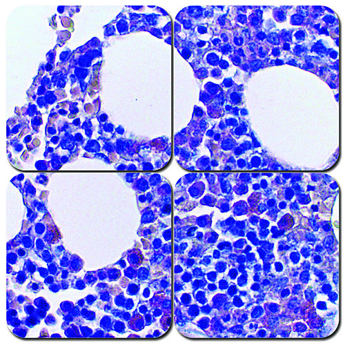 Giemsa/May-Grunwald Stain Kit