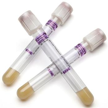 Vacutainer® Plasma Preparation Tubes (PPT™)