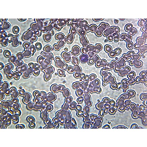 Prepared Microscope Slide Iron Deficient Anemia Blood Smear